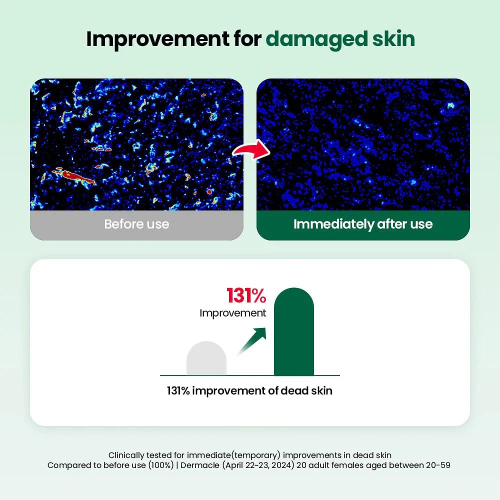 Dr.G R.E.D Blemish Clear Double Soft Pads 60 Renewal - Image 5