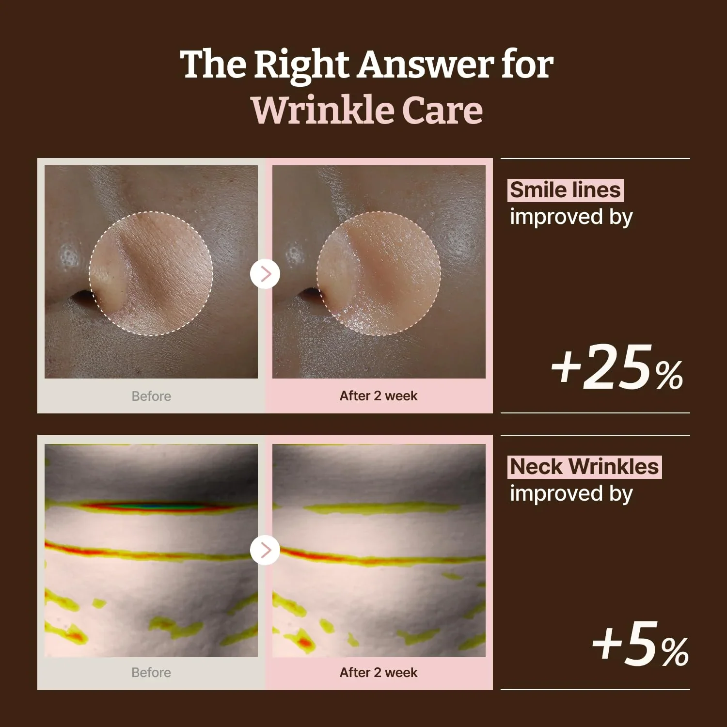 Dr.Reju-All Advanced Pdrn Rejuvenating Mask 4Pcs - Image 4