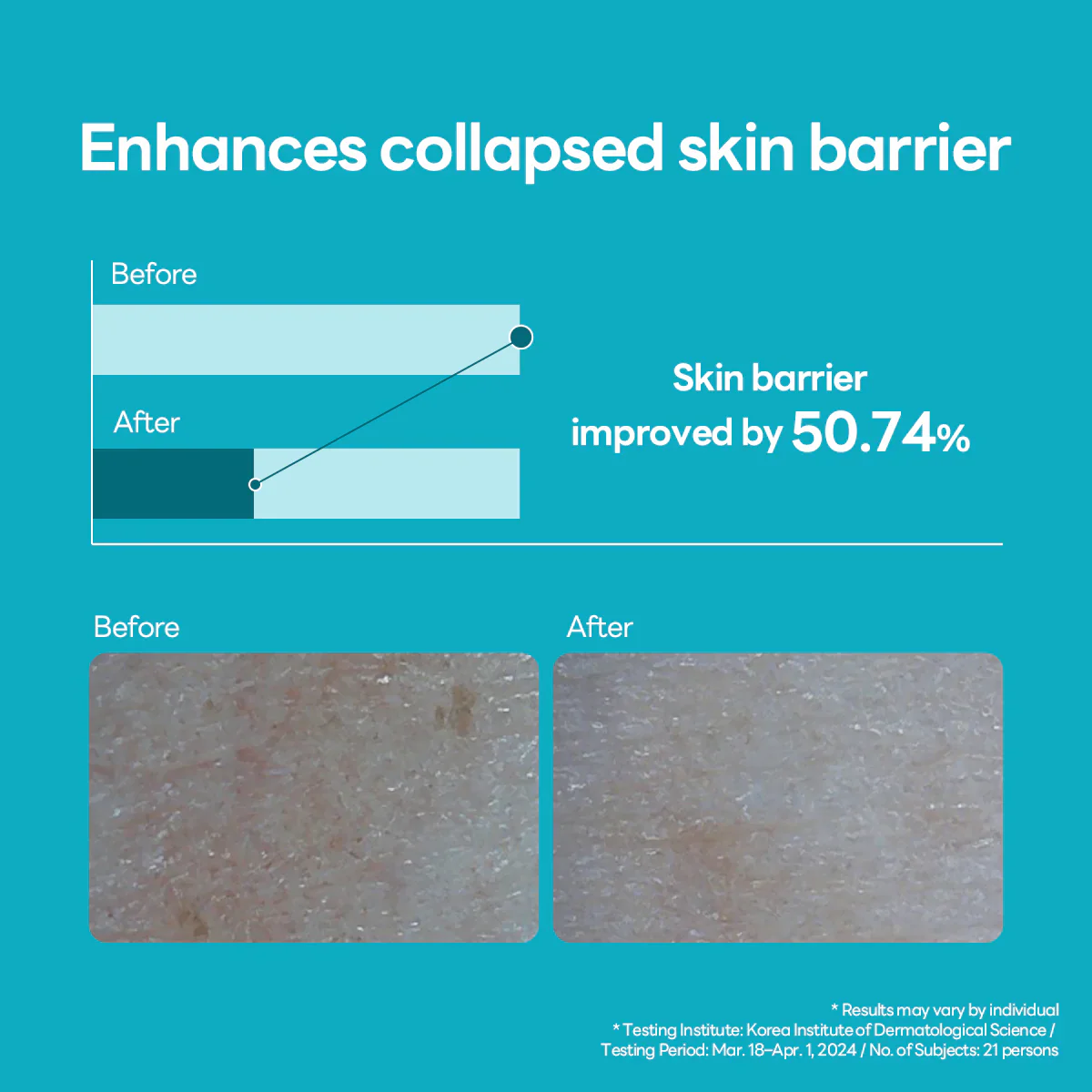 Mediheal Madecassoside Blemish Repair Serum 40ml - Image 6