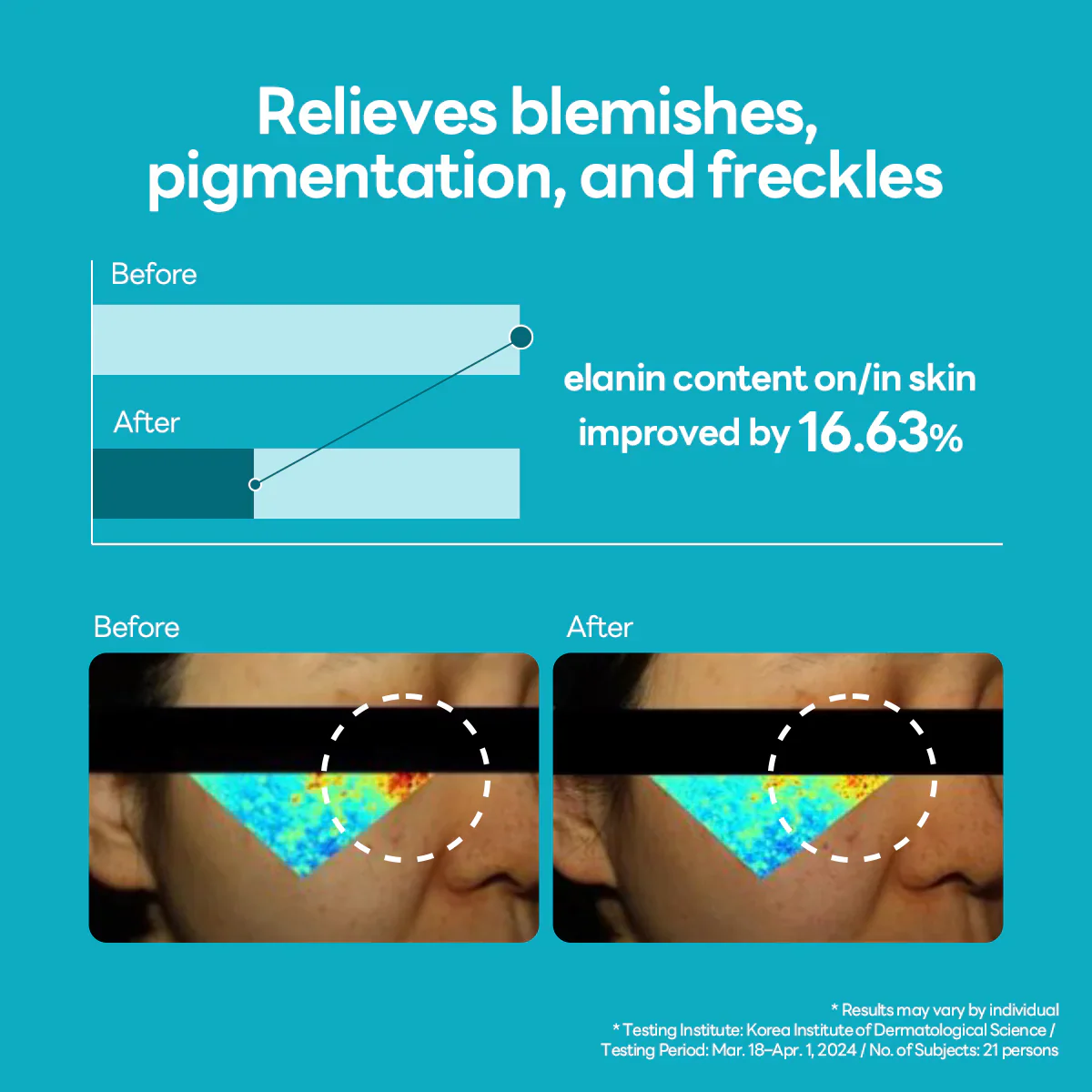 Mediheal Madecassoside Blemish Repair Serum 40ml - Image 7